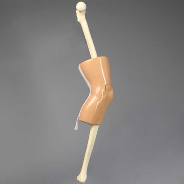 Knee, Encased with Incision Points