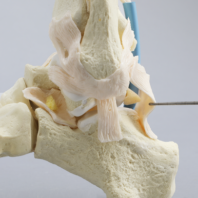 Able Advanced Arthroscopy Ankle