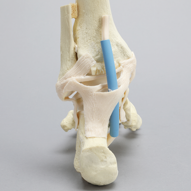 Able Advanced Arthroscopy Ankle