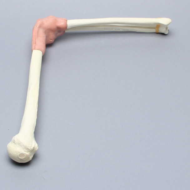 Arthroscopy Elbow Insert