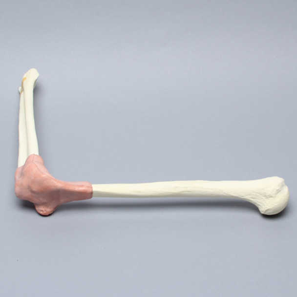 Arthroscopy Elbow Insert
