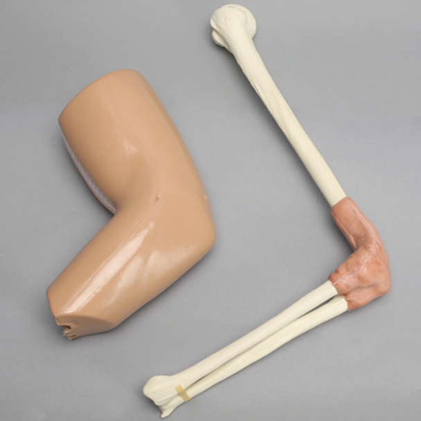 Arthroscopy Elbow