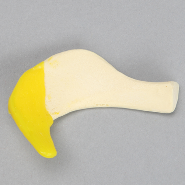 Subacromial Bursa