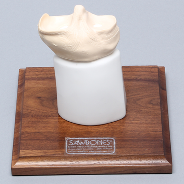 Tibial Plug