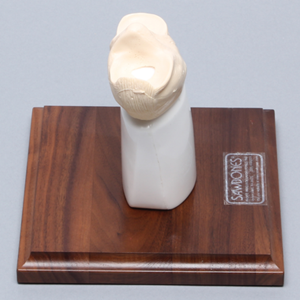 Tibial Plug