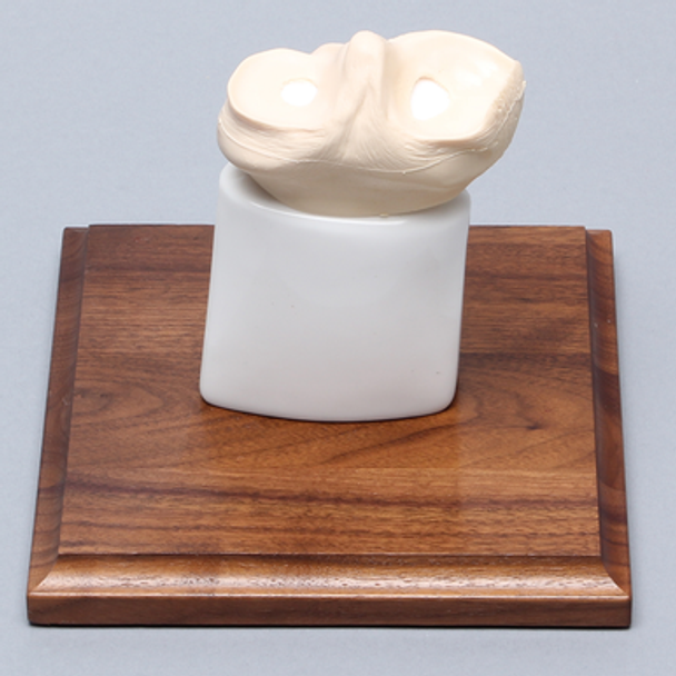 Tibial Plug