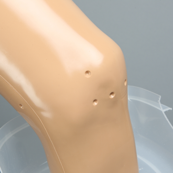 Knee, Wet Arthroscopy, Large