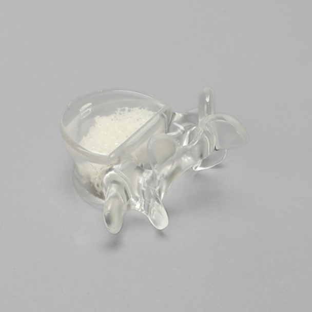 Vertebra, L5, With Replaceable Insert, 4.5mm Pedicle Entry Sites, Transparent Cortical