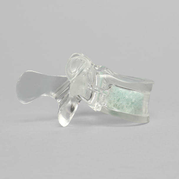 Vertebra L3 with Replaceable Cancellous Insert