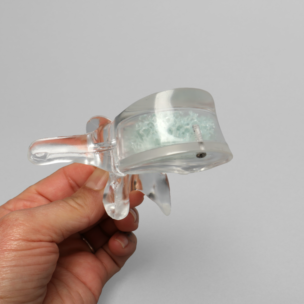 Vertebra L3 with Replaceable Cancellous Insert