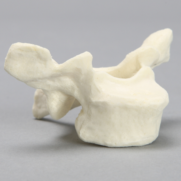 Vertebra, T2, Foam Cortical