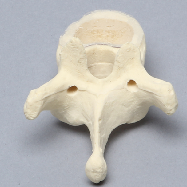 Vertebra, T10, Clear Window, Foam Cortical