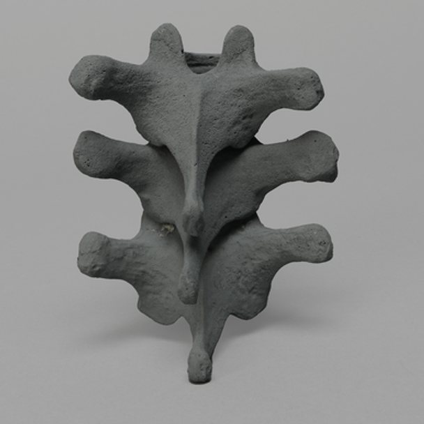 Thoracic, T10-T12, Osteoporotic Vertebrae