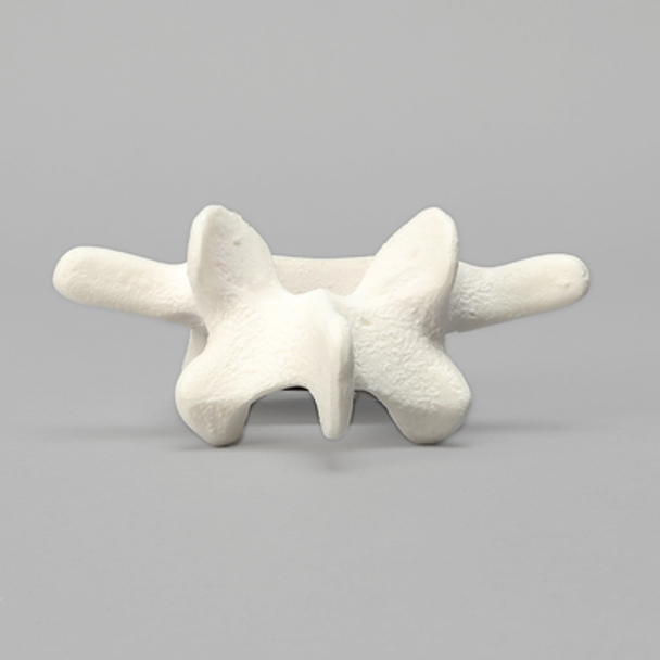 Vertebra, L4, Foam Cortical Shell, For Spinal Navigation