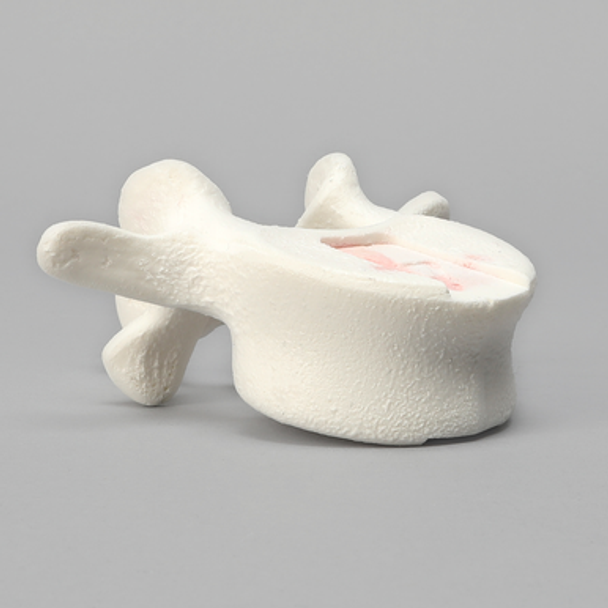 Vertebra, L4, Foam Cortical Shell, For Spinal Navigation