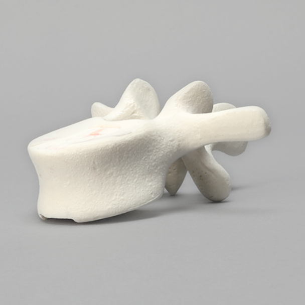 Vertebra, L3, Foam Cortical Shell, For Spinal Navigation