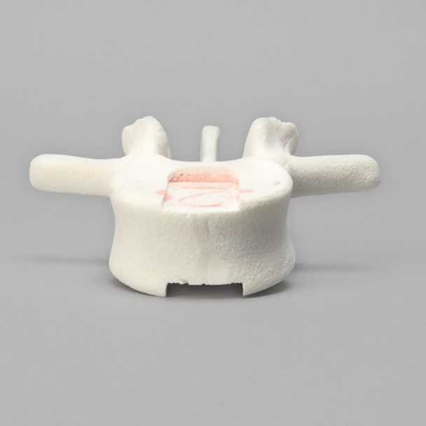 Vertebra, L2, Foam Cortical Shell, For Spinal Navigation