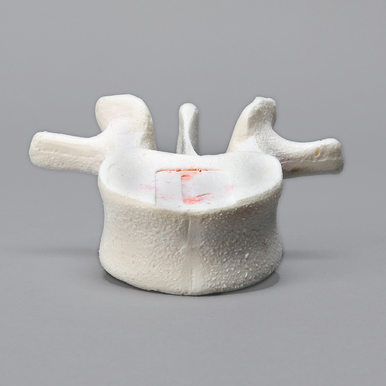 Vertebra, L1, Foam Cortical Shell, For Spinal Navigation