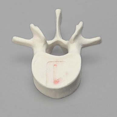 Vertebra, L1, Foam Cortical Shell, For Spinal Navigation
