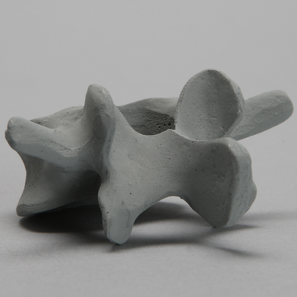 Vertebra, L4, Osteoporotic, Radiopaque