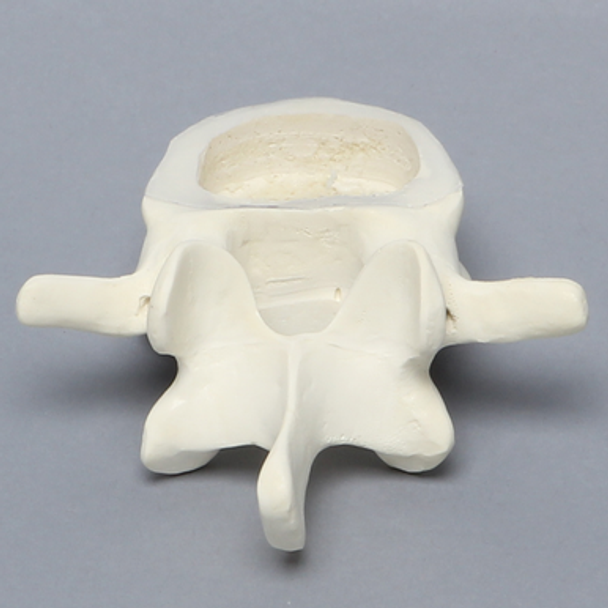 Vertebra, L4, Clear Window, Foam Cortical