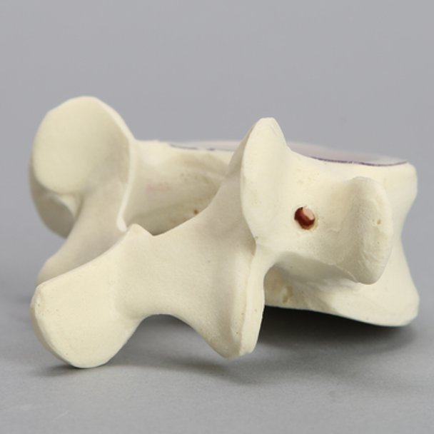 Vertebra, L5, Clear Window, Foam Cortical
