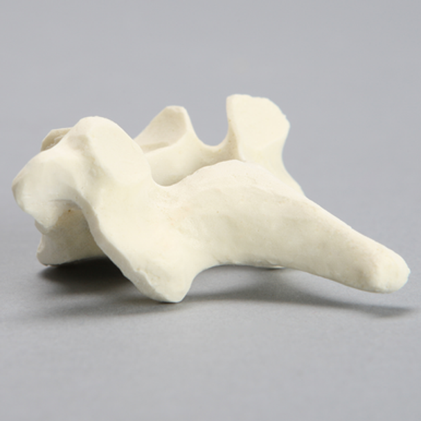 Vertebra, C7, Solid Foam