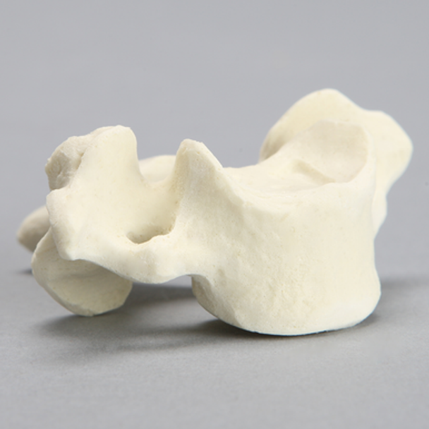 Vertebra, C7, Solid Foam
