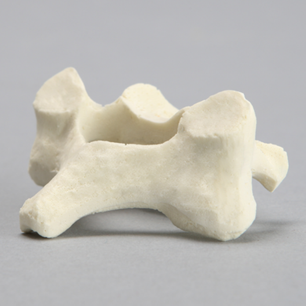 Vertebra, C5, Solid Foam
