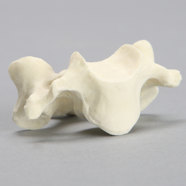 Vertebra, C3, Solid Foam