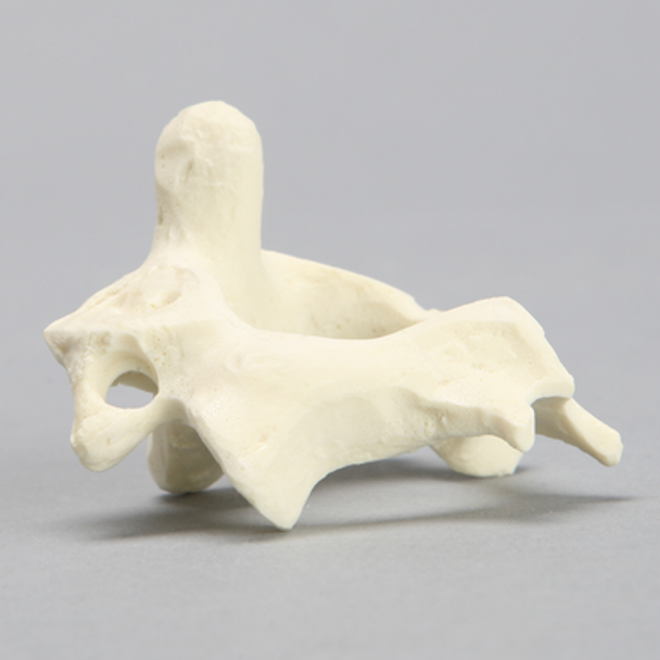 Vertebra, C2, Solid Foam