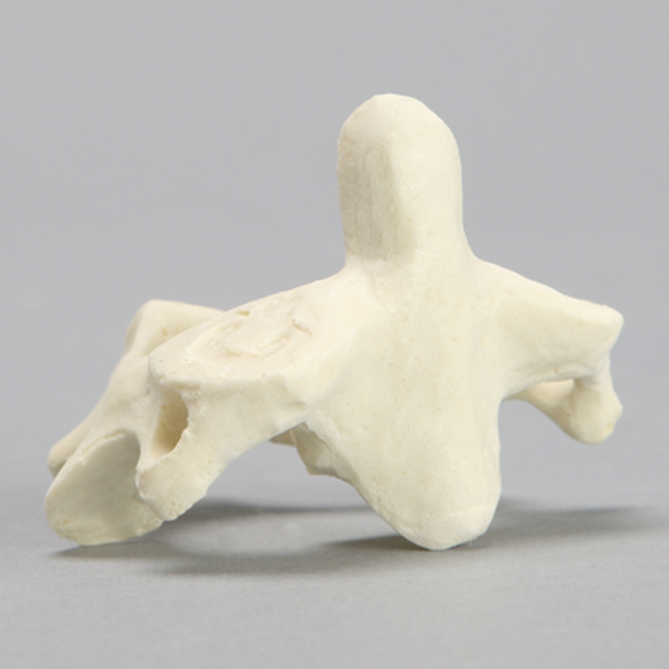 Vertebra, C2, Solid Foam