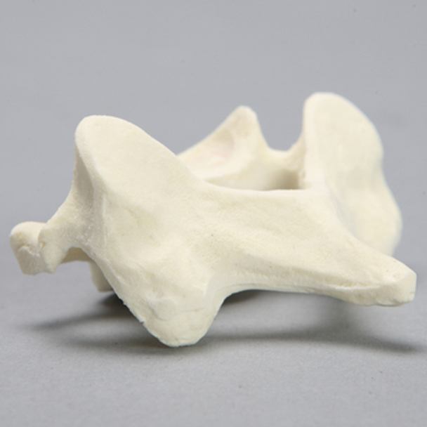 Vertebra, C6, Foam Cortical