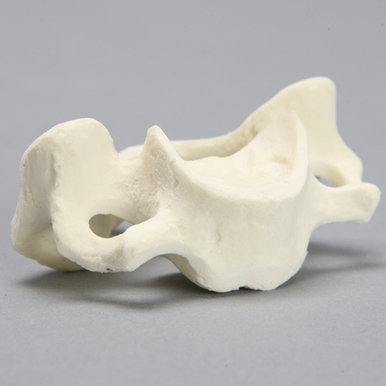 Vertebra, C6, Foam Cortical