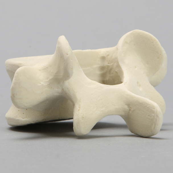 Vertebra, L5, Solid Foam
