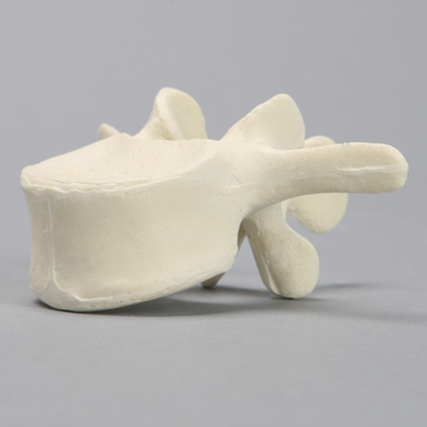 Vertebra, L3, Solid Foam