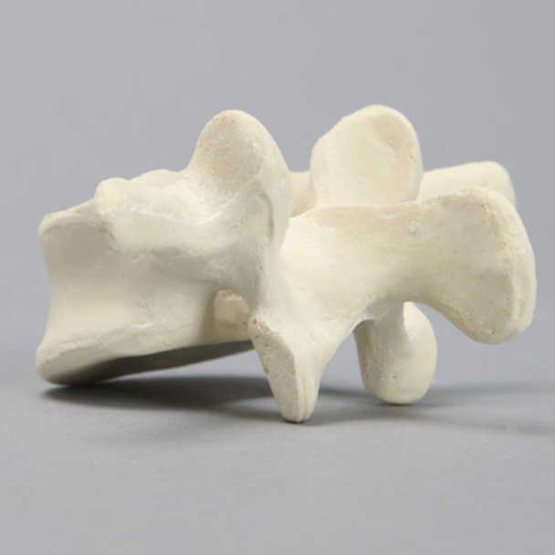 Vertebra, L3, Solid Foam