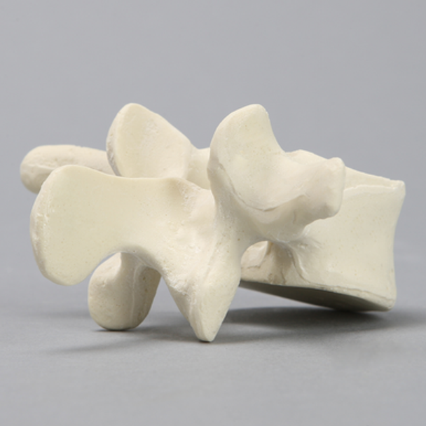 Vertebra, L3, Solid Foam