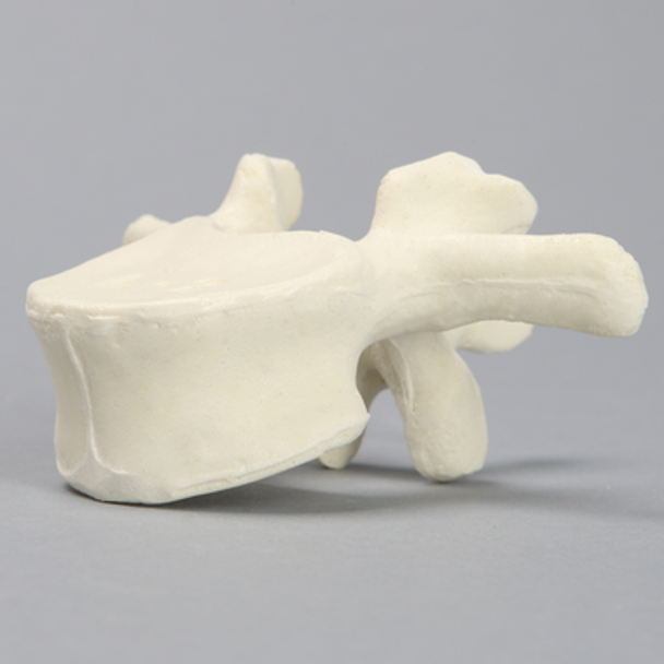 Vertebra, L2, Solid Foam