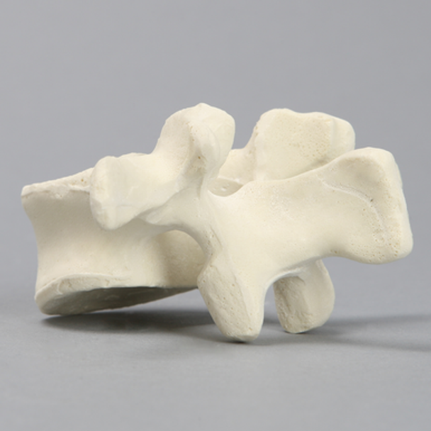 Vertebra, L2, Solid Foam
