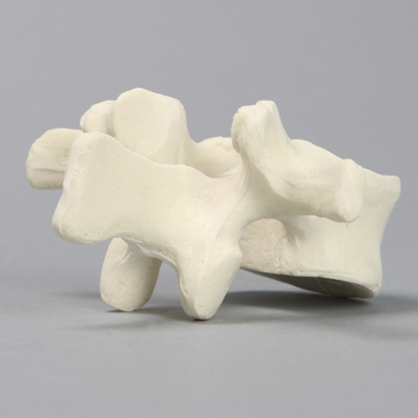 Vertebra, L2, Solid Foam