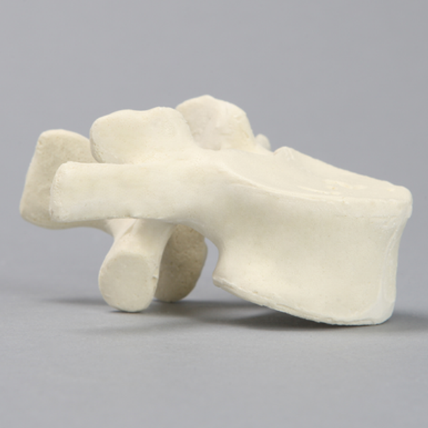 Vertebra, L2, Solid Foam