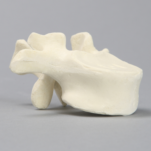 Vertebra, L1, Solid Foam