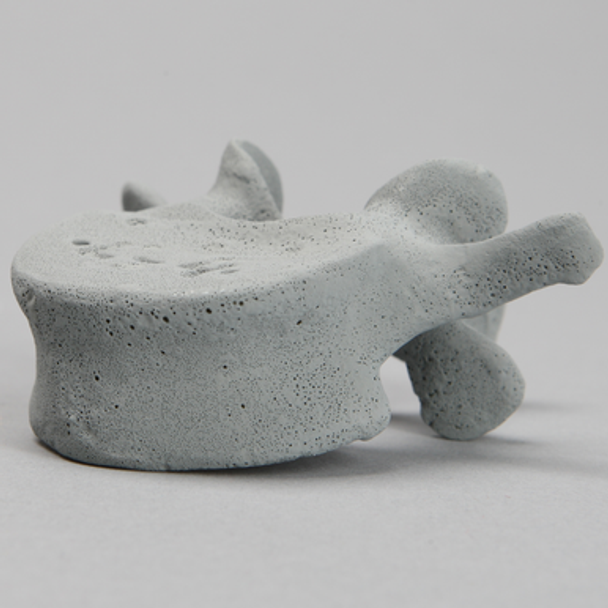 Vertebra, L4, Radiopaque