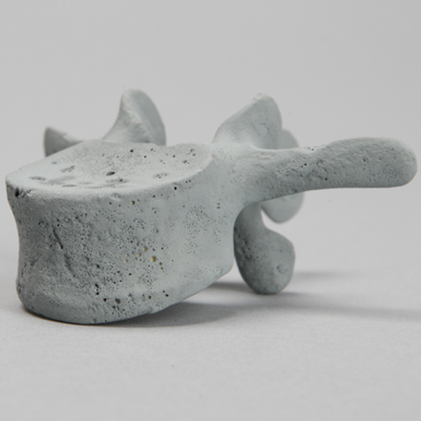 Vertebra, L3, Radiopaque