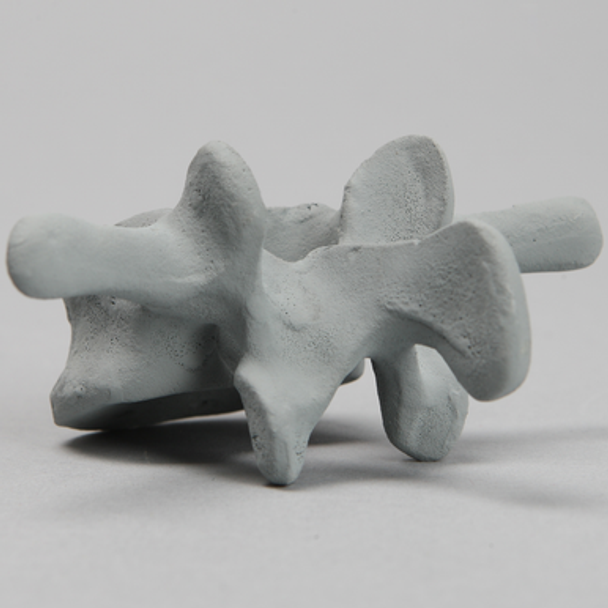 Vertebra, L3, Radiopaque