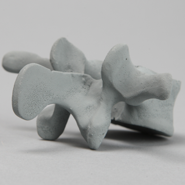 Vertebra, L3, Radiopaque