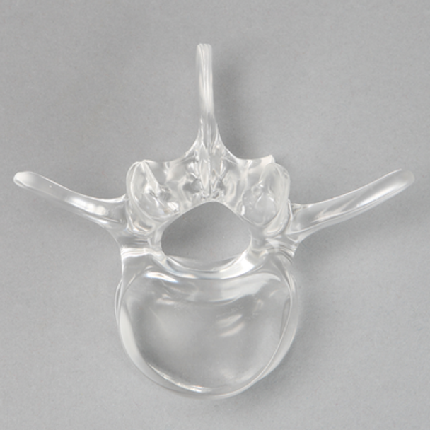Vertebra L3, Solid Clear Plastic