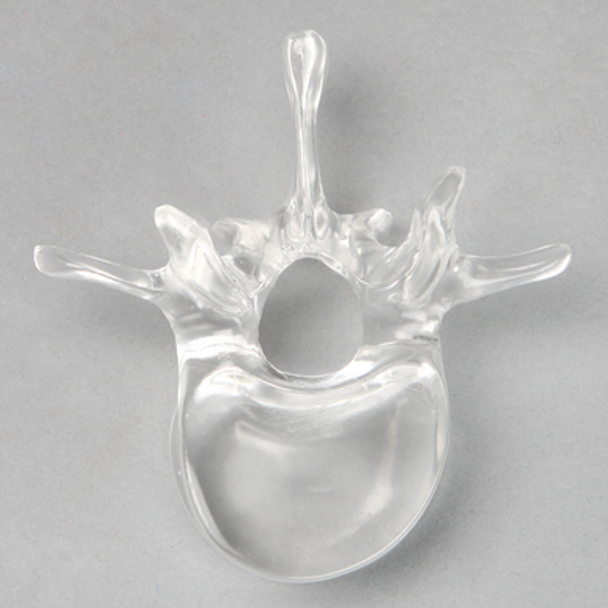 Vertebra L1, Solid Clear Plastic