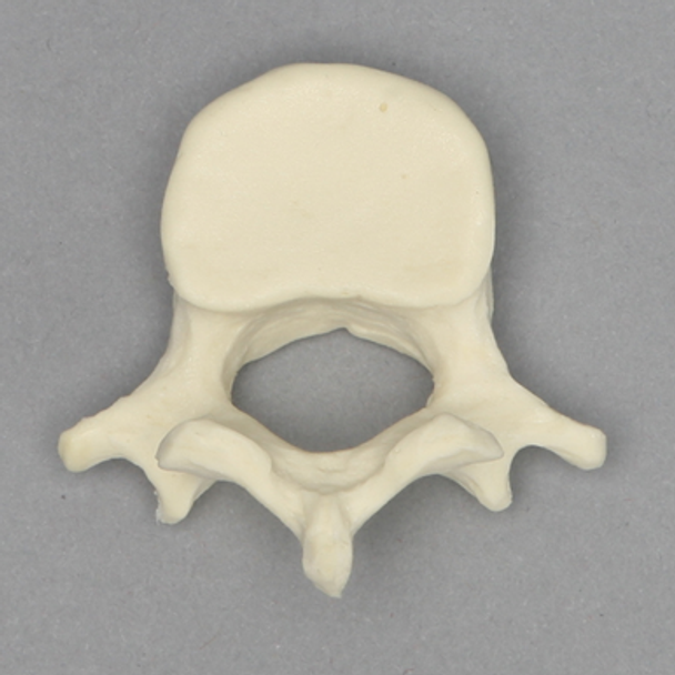 Vertebra, L4, Pediatric, Solid Foam